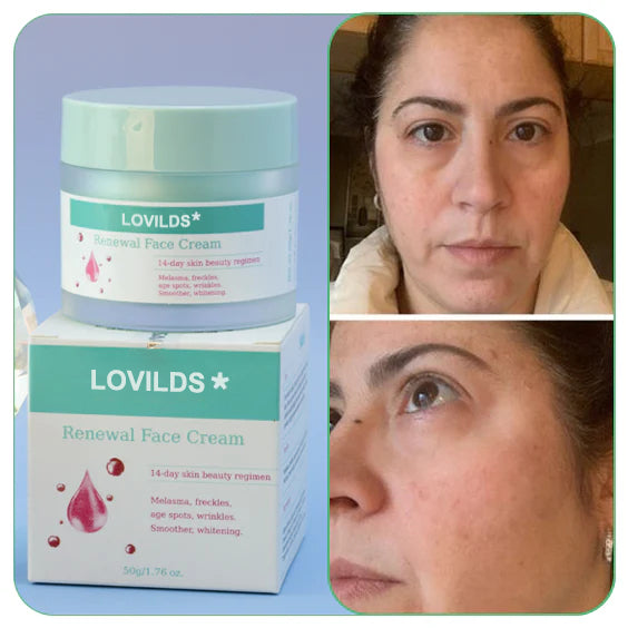 Final Hours—Sale Ending Soon!💥LOVILDS* Renewal Skin Cream | Spot Removal & Skin Renewal for Dark Spots, Age Spots, and Sun Spots* Daily Firming for All Skin Types