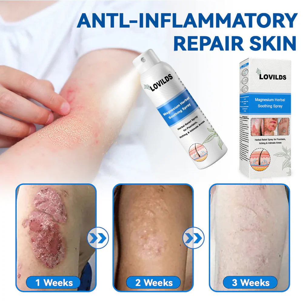 ✅ Official Store: LOVILDS® Magnesium Herbal Psoriasis Spray 👨⚕️ FDA Certified (Relieves Psoriasis and Eczema, Improves Bacterial Infections in the Genital Area, Treats Acne and Warts)