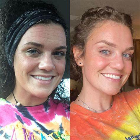 Final Hours—Sale Ending Soon!💥LOVILDS* Renewal Skin Cream | Spot Removal & Skin Renewal for Dark Spots, Age Spots, and Sun Spots* Daily Firming for All Skin Types