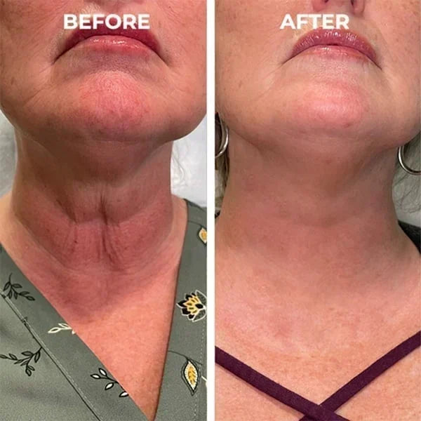 Final Hours—Sale Ending Soon!💥LOVILDS* Renewal Skin Cream | Spot Removal & Skin Renewal for Dark Spots, Age Spots, and Sun Spots* Daily Firming for All Skin Types
