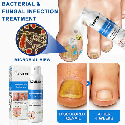 ✅ Official Store: LOVILDS® Magnesium Herbal Psoriasis Spray 👨‍⚕️ FDA Certified (Relieves Psoriasis and Eczema, Improves Bacterial Infections in the Genital Area, Treats Acne and Warts)